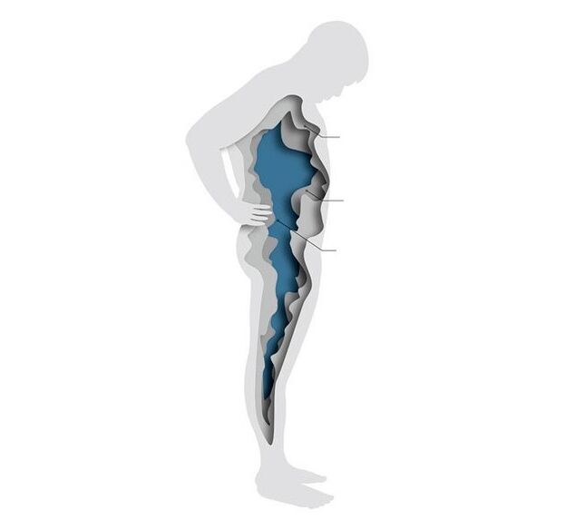 hormones and obesity
